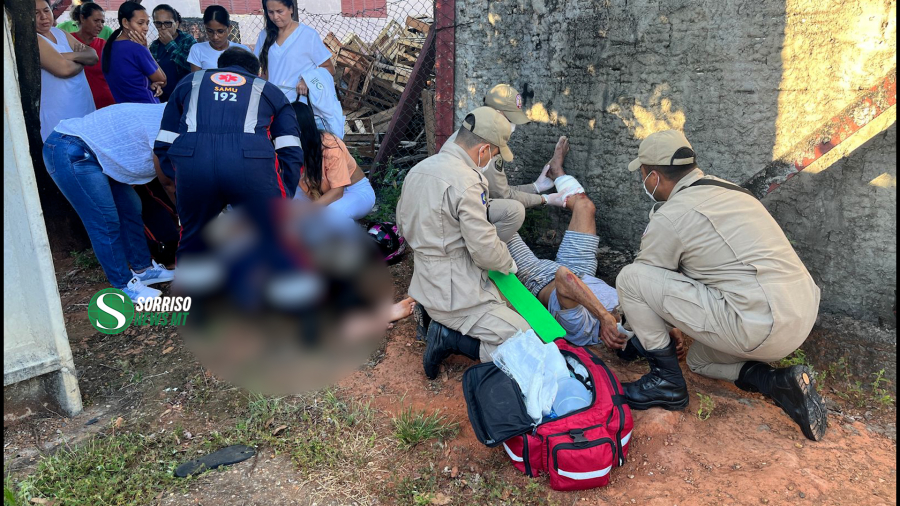 Motociclista sofre fratura exposta e criança fica ferida em grave acidente no Jardim Primavera; VEJA O VÍDEO